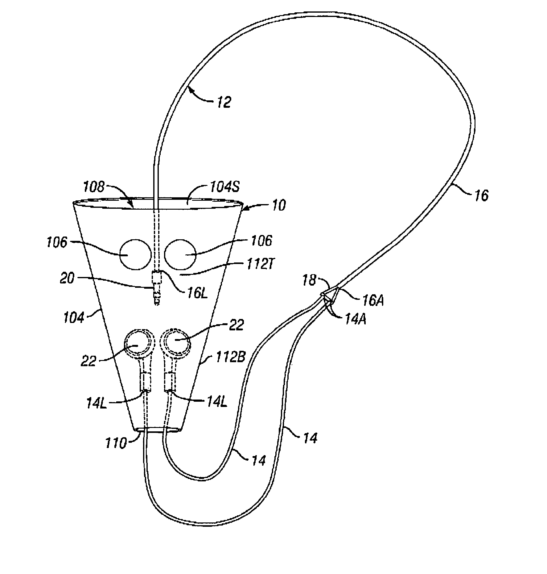 Cord management method and sleeve for ends of Y-shaped cords