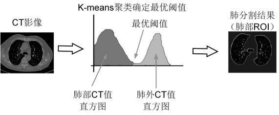 A CT image processing method for predicting the prognosis of new coronary pneumonia