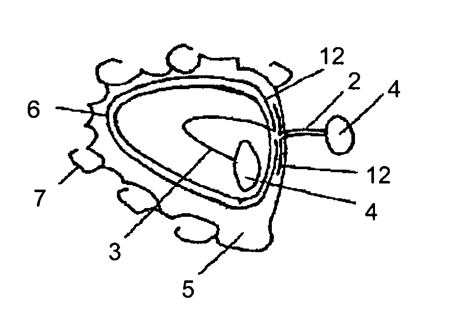 Removable tongue position corrective anti-snoring and anti-suffocating device