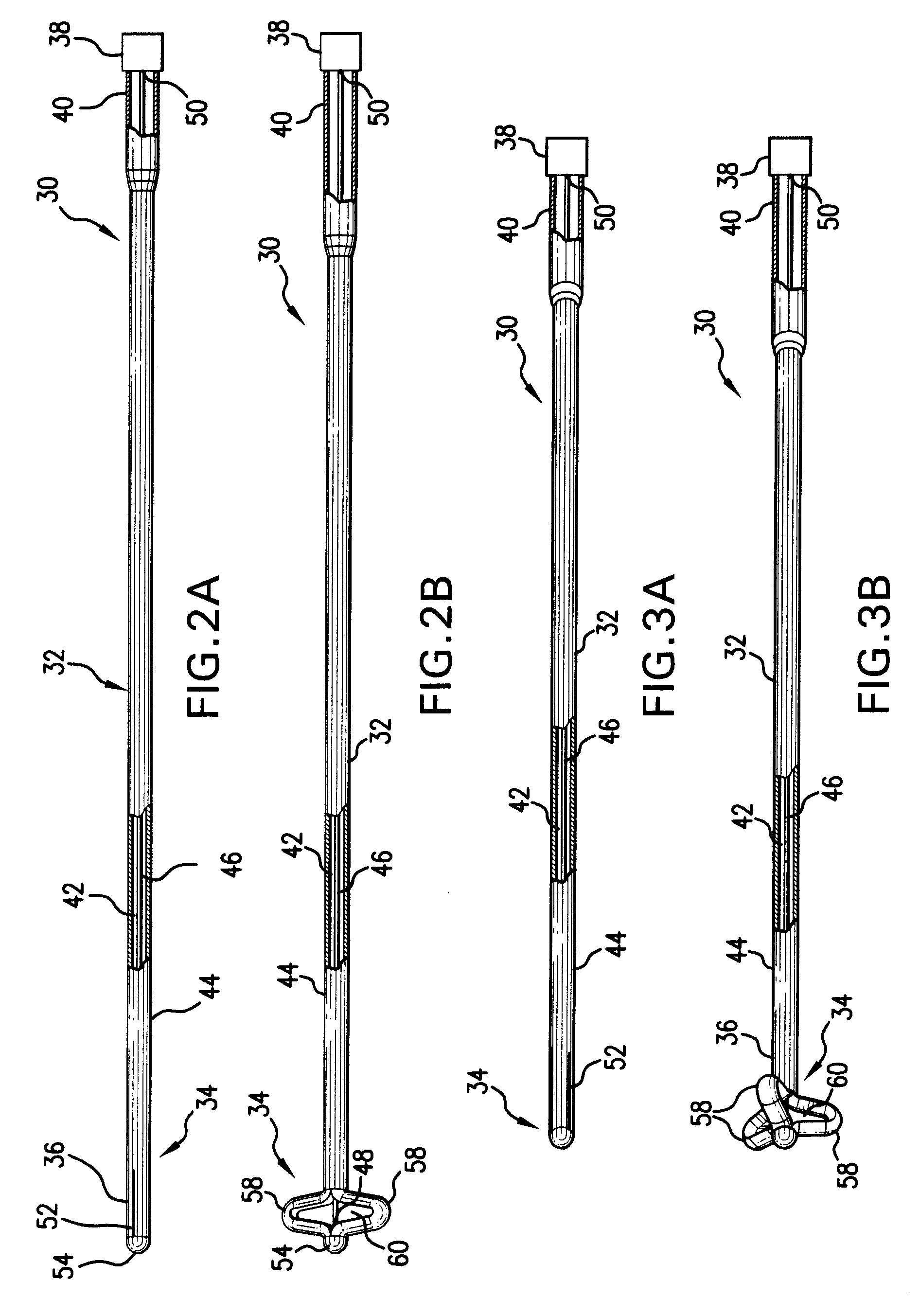Indwelling urinary catheter with self-retaining mechanism