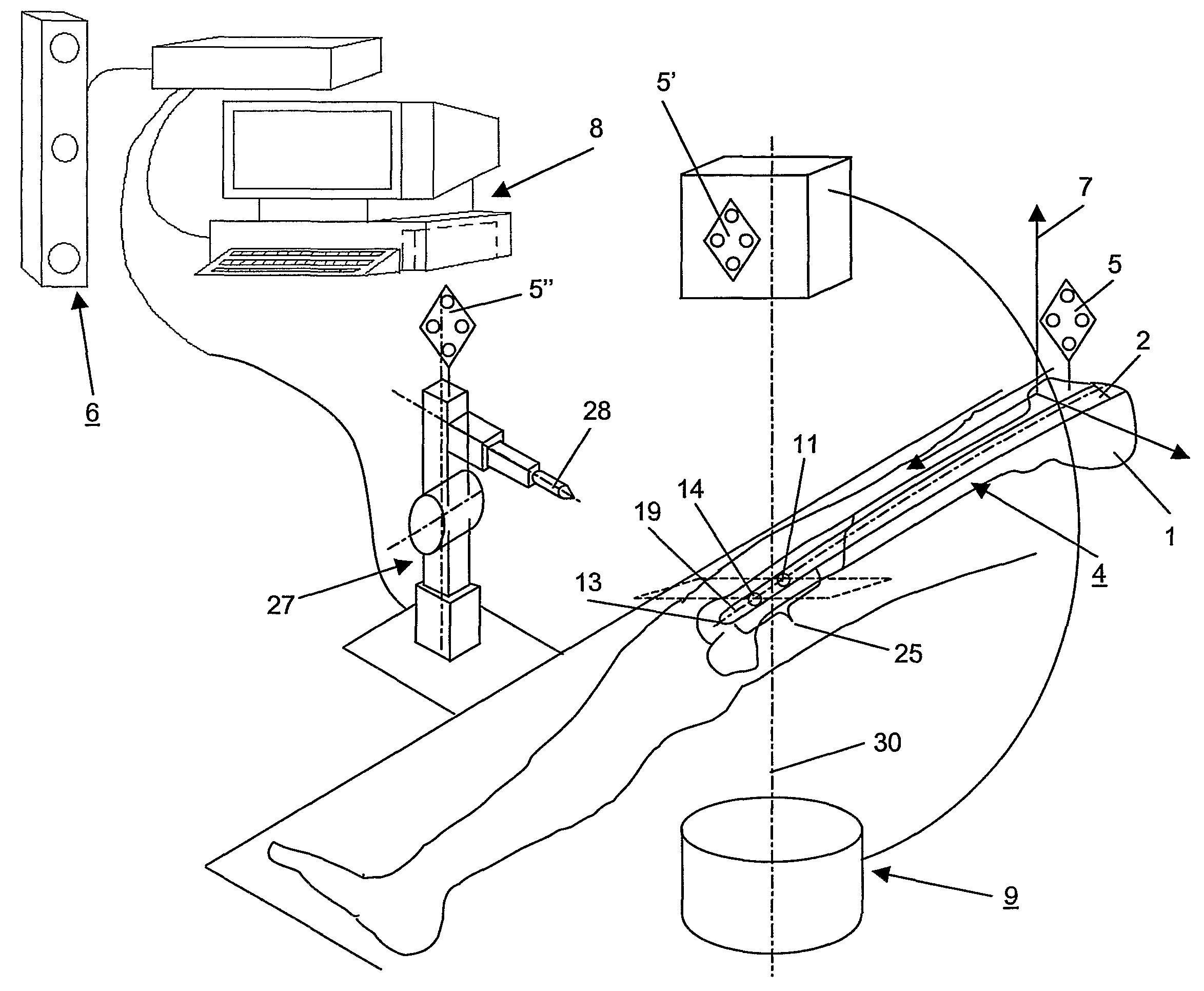 Method and device for computer assisted distal locking of intramedullary nails