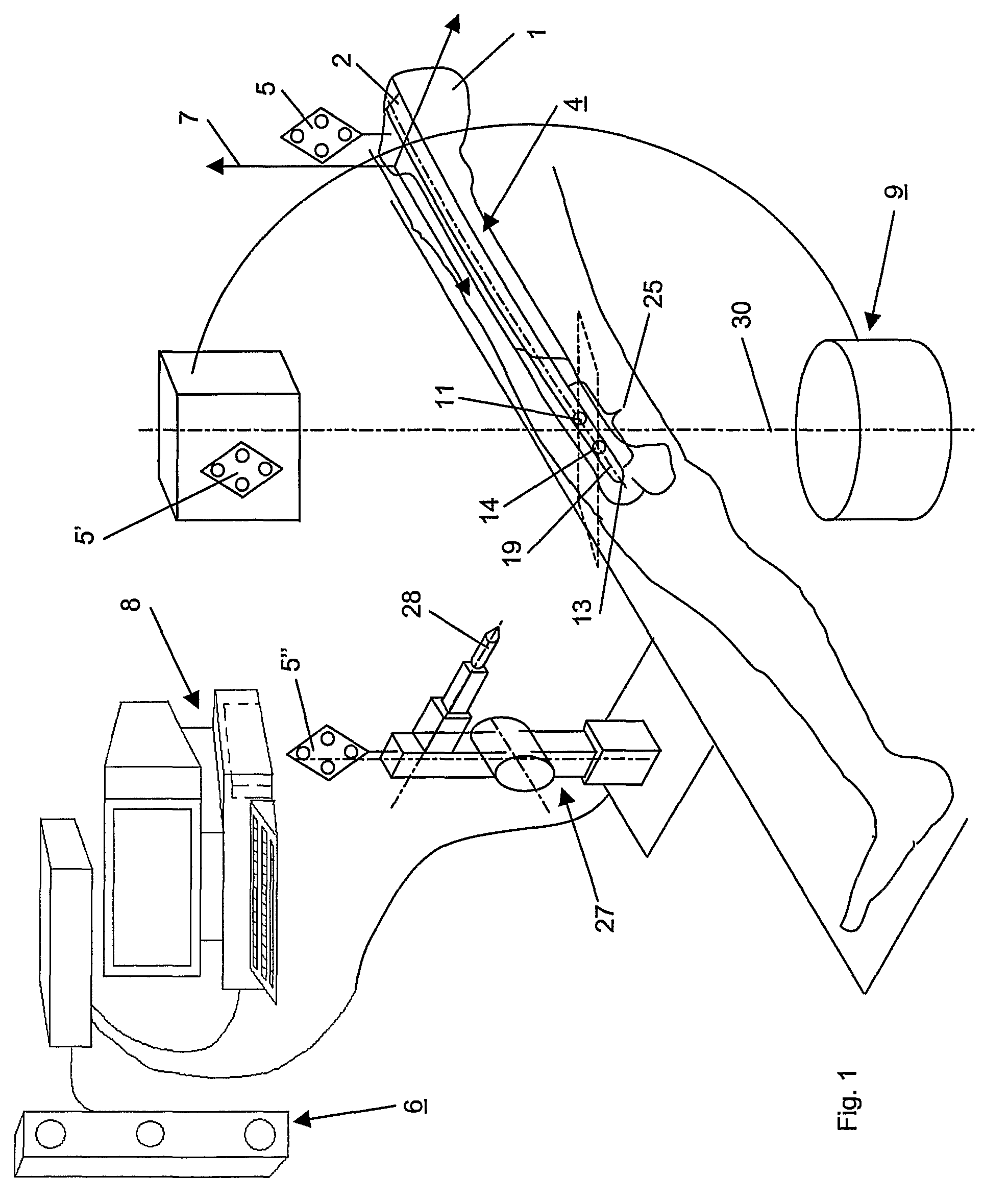 Method and device for computer assisted distal locking of intramedullary nails