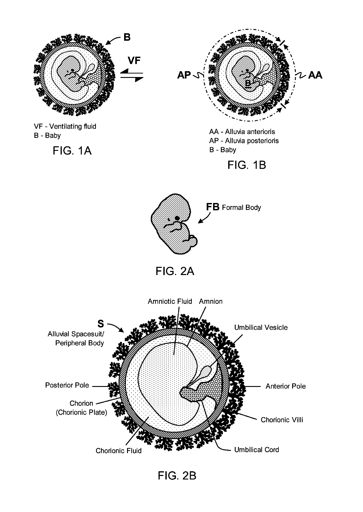 Nondestructive means of ectopic pregnancy management