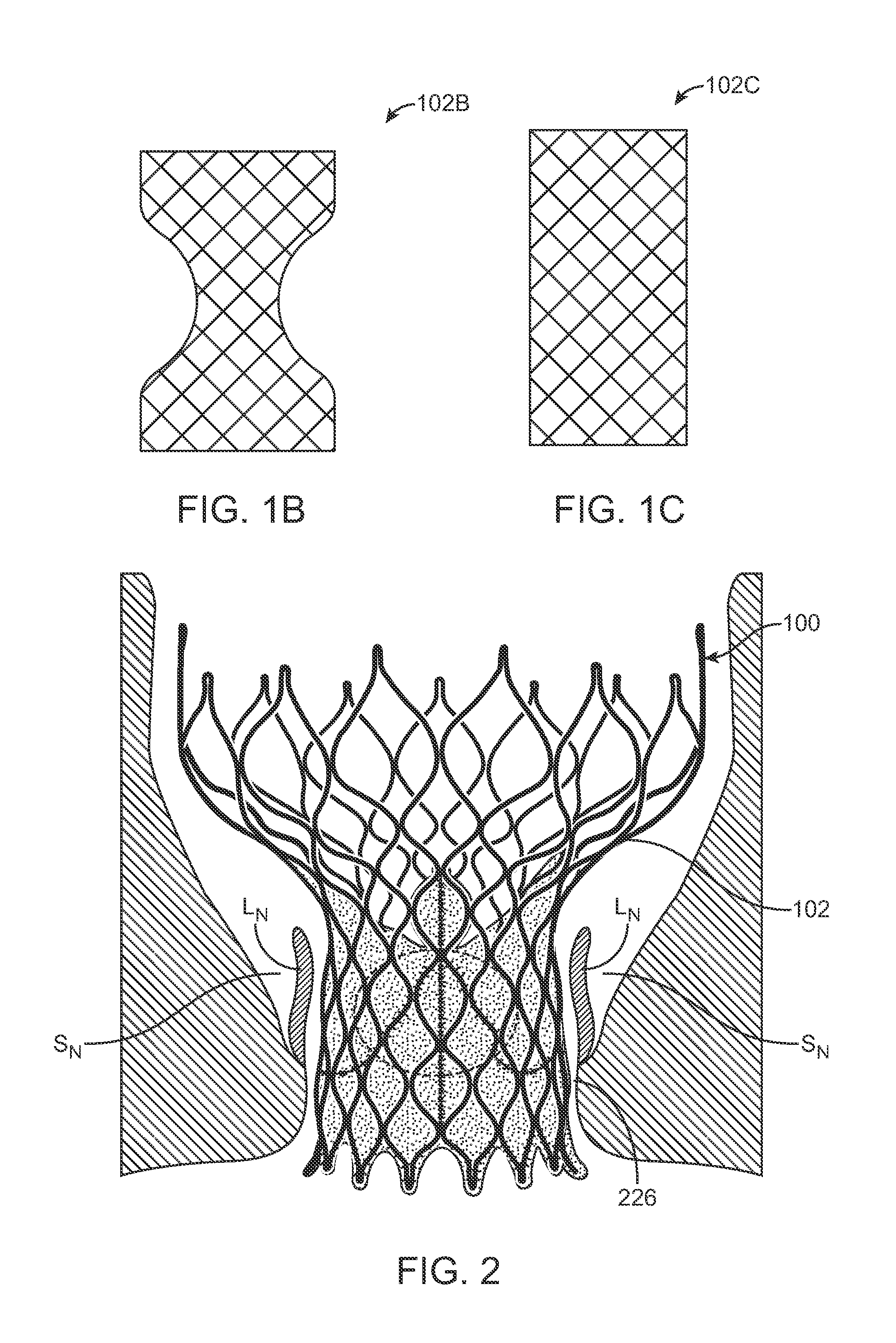 Methods and Devices for Repairing and/or Preventing Paravalvular Leakage Post-Implantation of a Valve Prosthesis