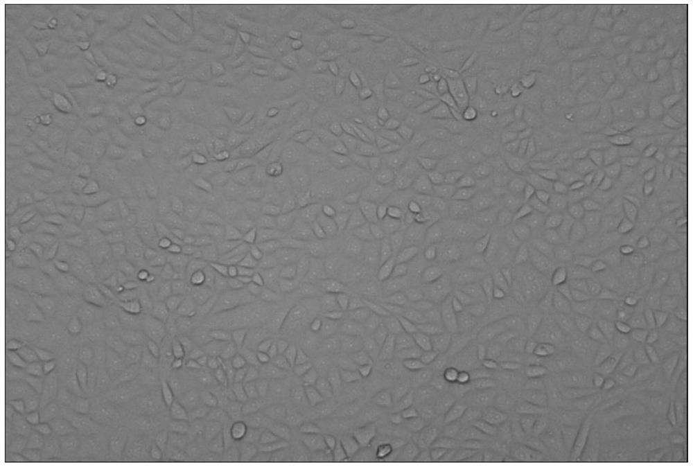 A kind of preparation method of trypsin