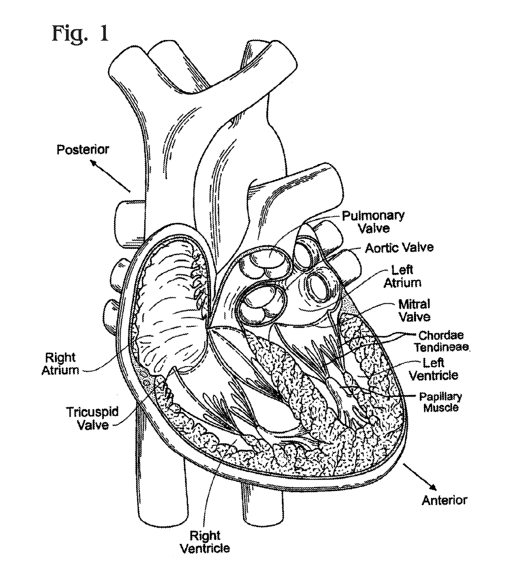 Methods of delivery of flexible heart valves