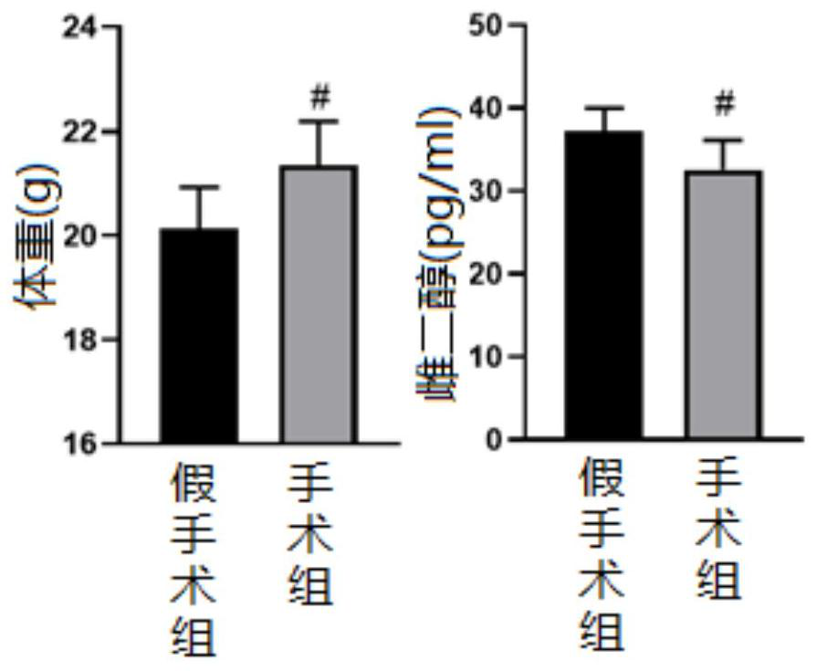 Application of columbianadin in preparation of medicines for preventing and/or treating osteoporosis