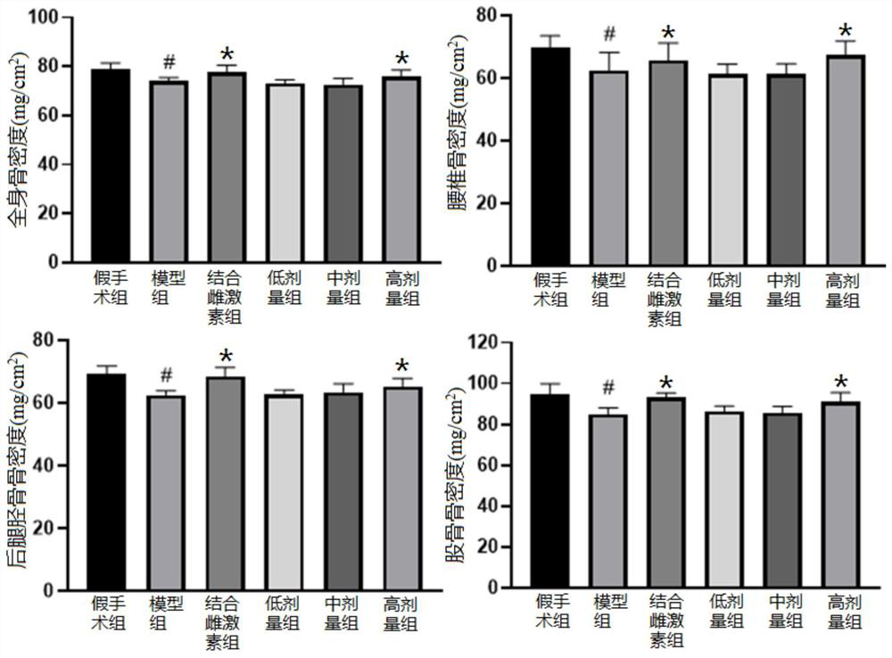 Application of columbianadin in preparation of medicines for preventing and/or treating osteoporosis