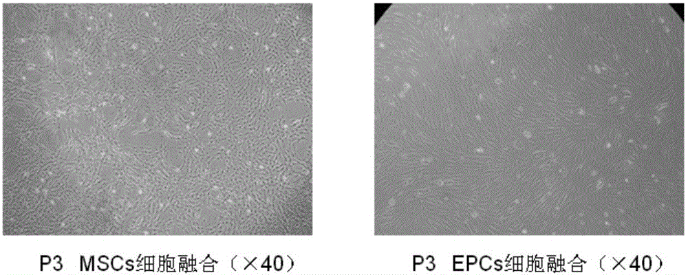 Improved stem/progenitor cell and regenerative porcine islet cell co-culturing method