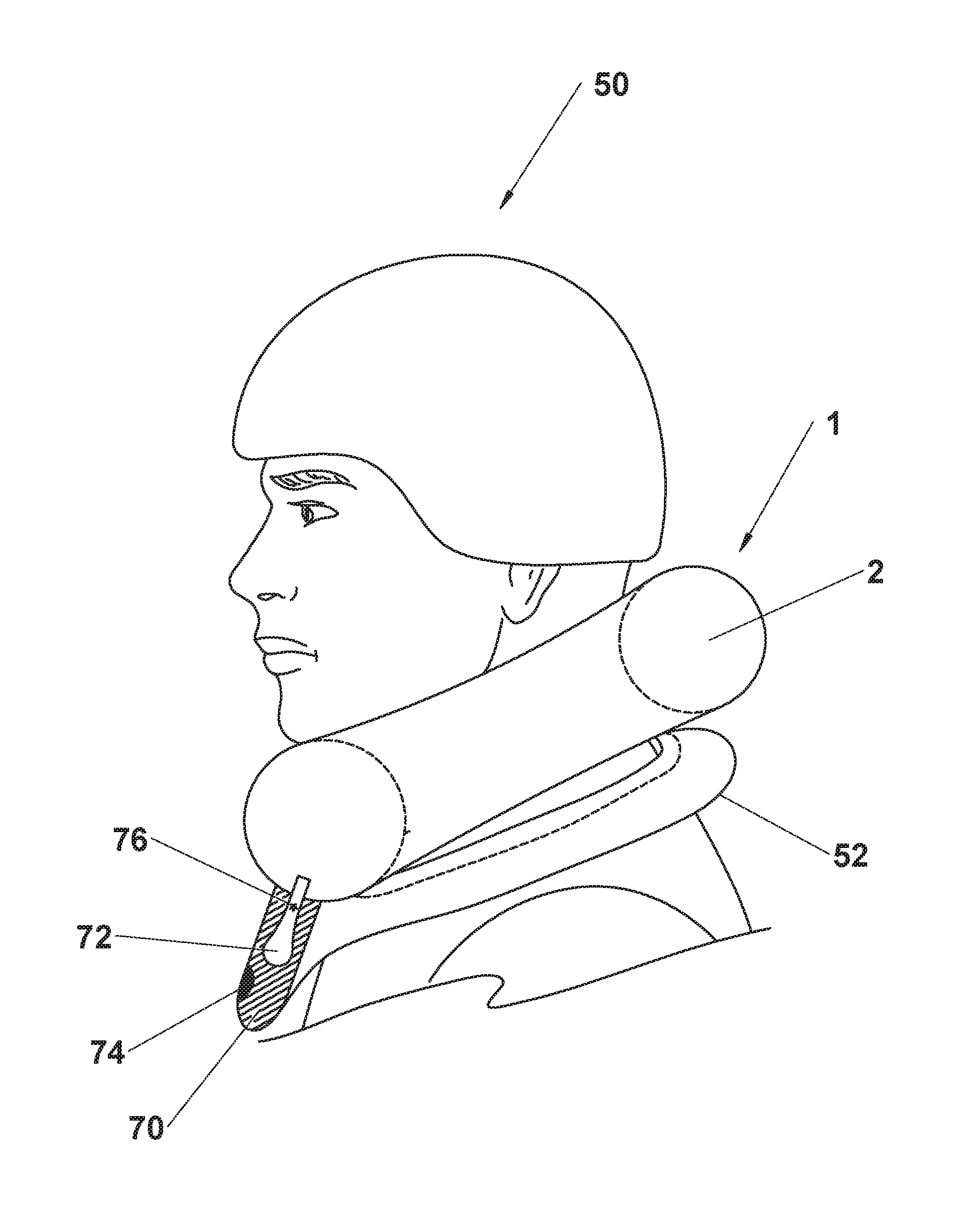 Inflatable blast-induced brain injury prevention device