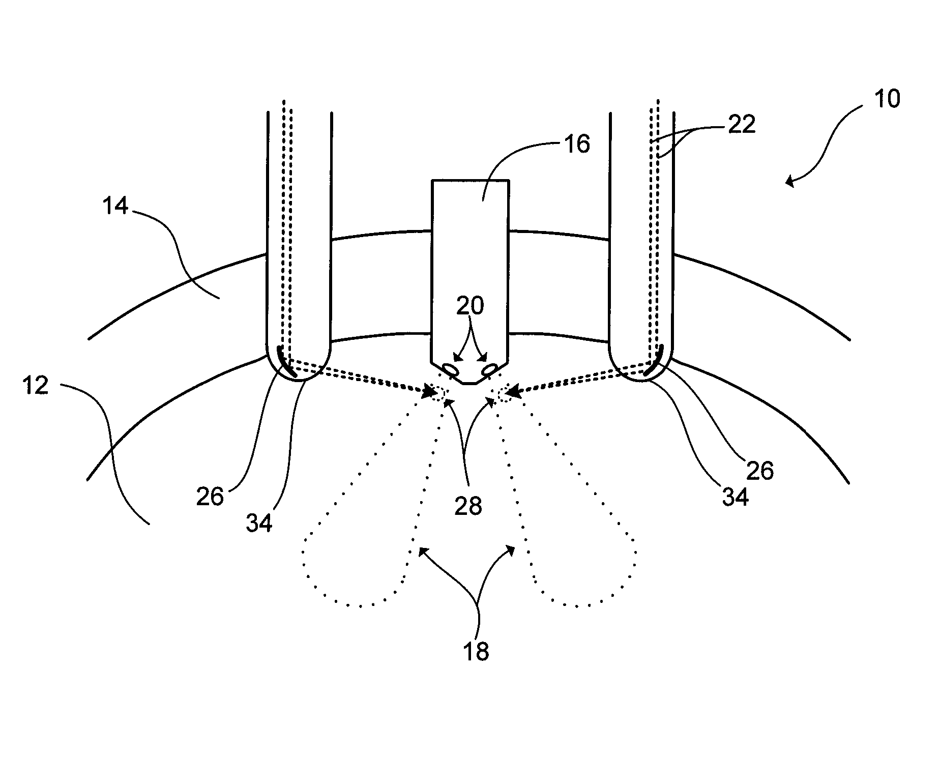 Devices and methods for conditioning or vaporizing liquid fuel in an intermittent combustion engine