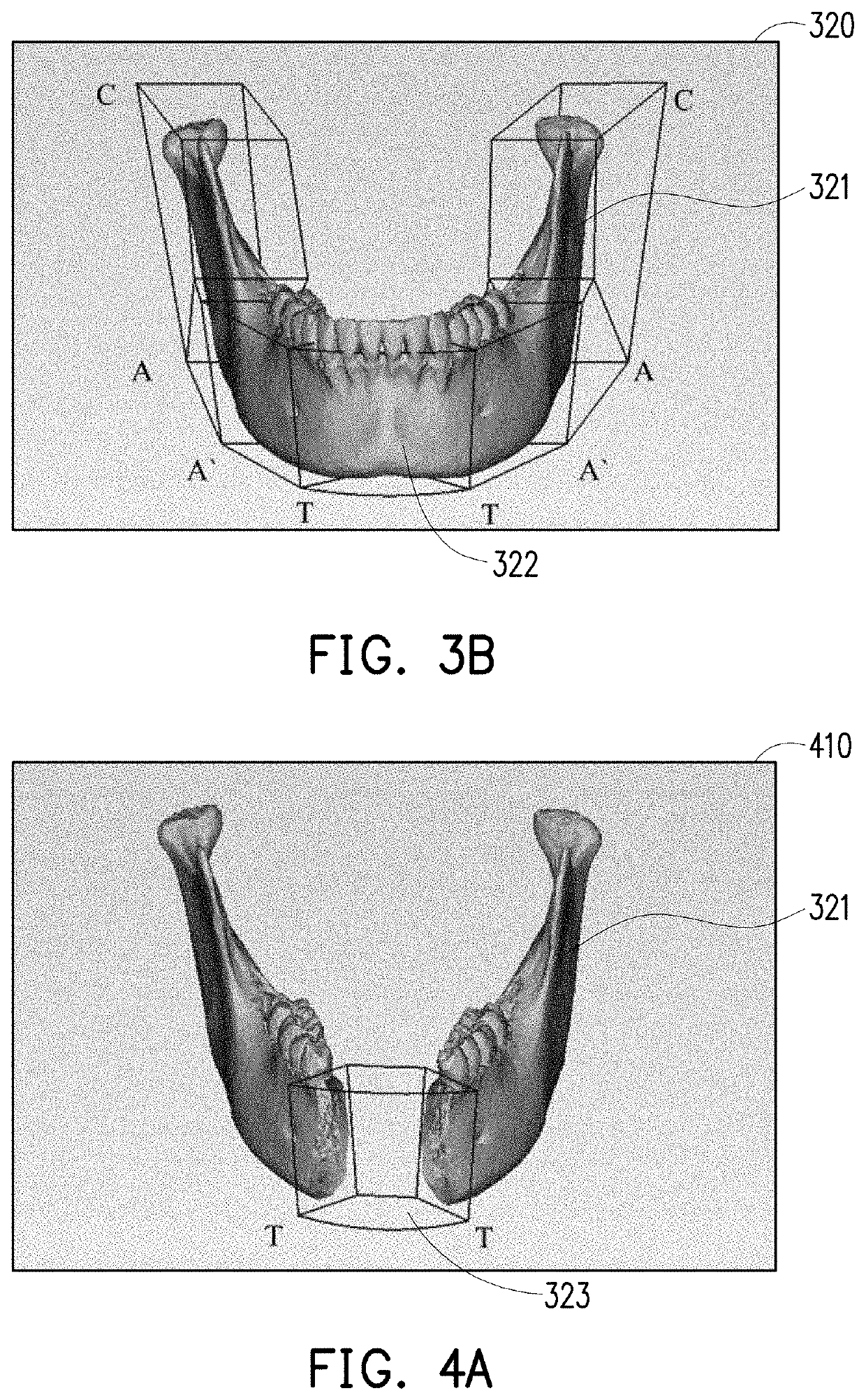 Medical image modeling system and medical image modeling method