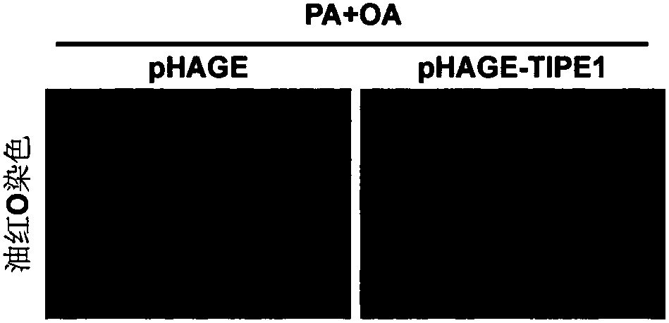 Application of tumor necrosis factor alpha-inducing protein 8-like molecule 1 in preparing medicine for treating fatty liver and related diseases