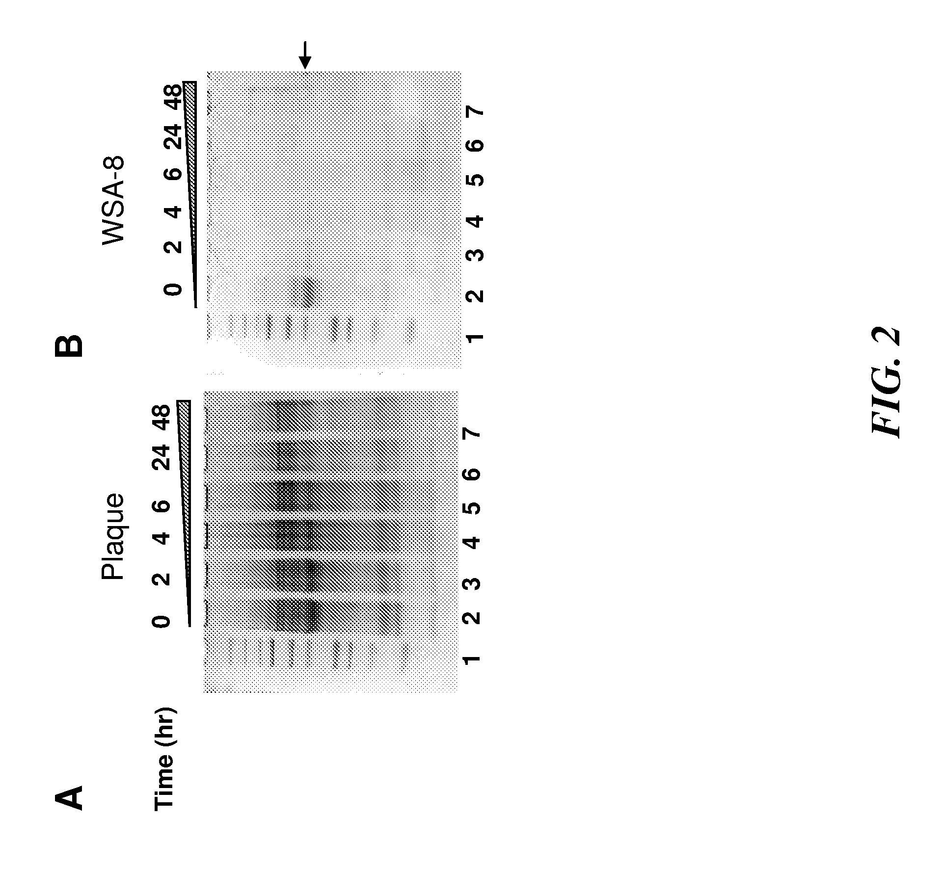 Rothia species glutamine endopeptidases and use thereof
