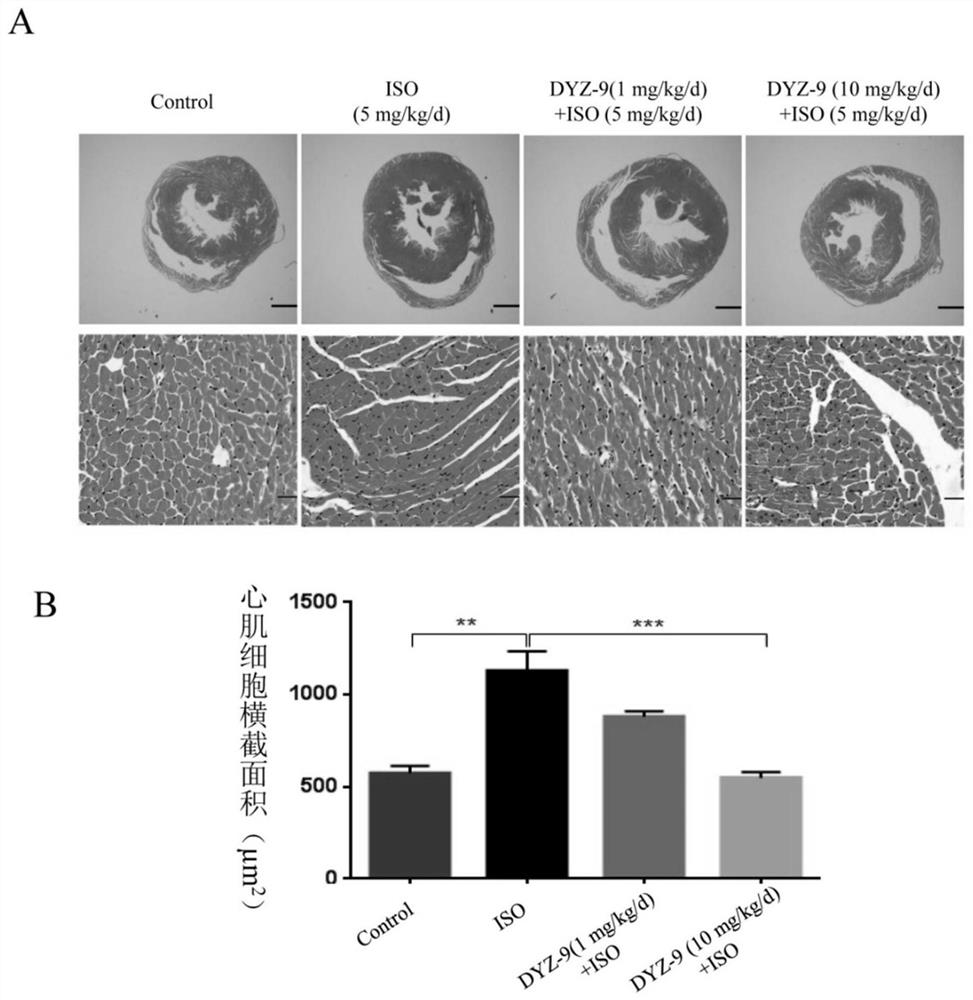 Application of dyz-9 in the preparation of anti-cardiac hypertrophy products