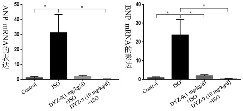 Application of dyz-9 in the preparation of anti-cardiac hypertrophy products