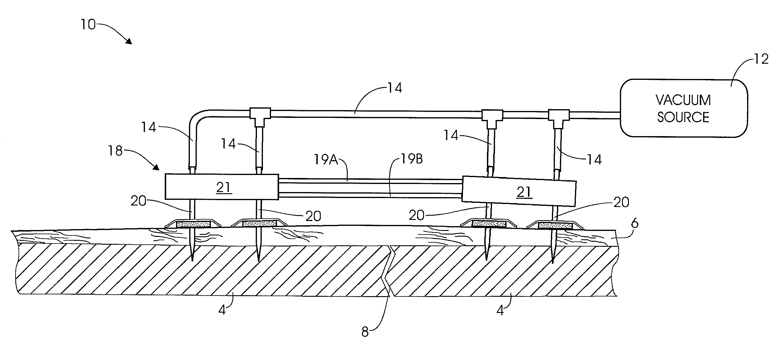 External fixation assembly and method of use
