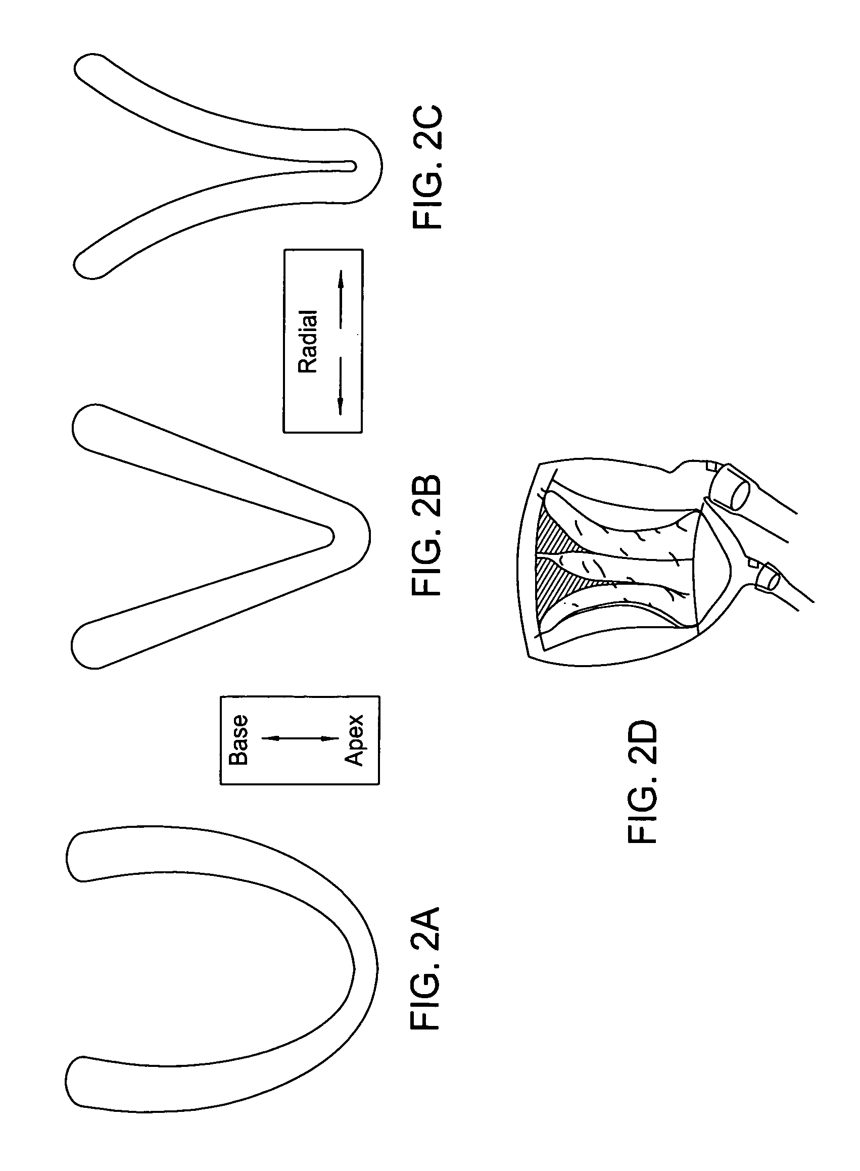 Device for proactive modulation of cardiac strain patterns