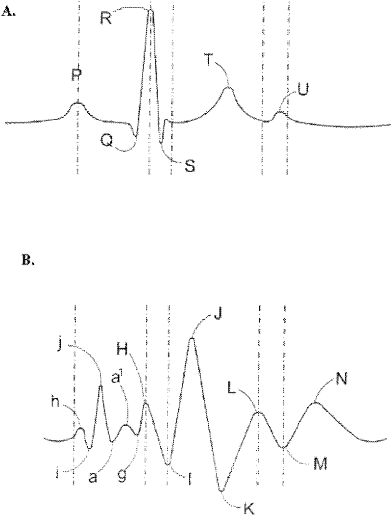Method and apparatus for obtaining and processing ballistocardiograph data