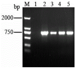 Saccharopolyspora spinosa rhamnose biosynthesis gene duplication engineering strain