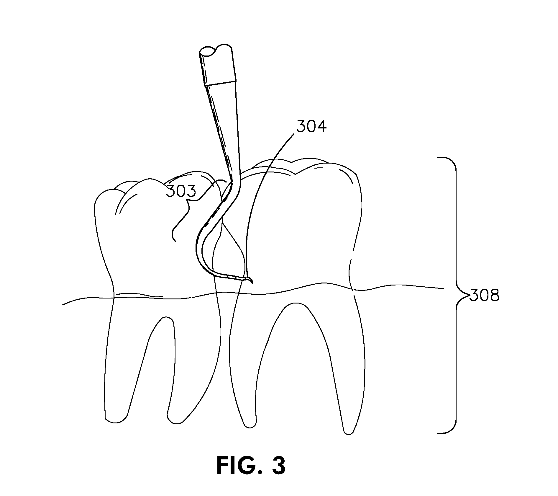 Area-specific dental instrument