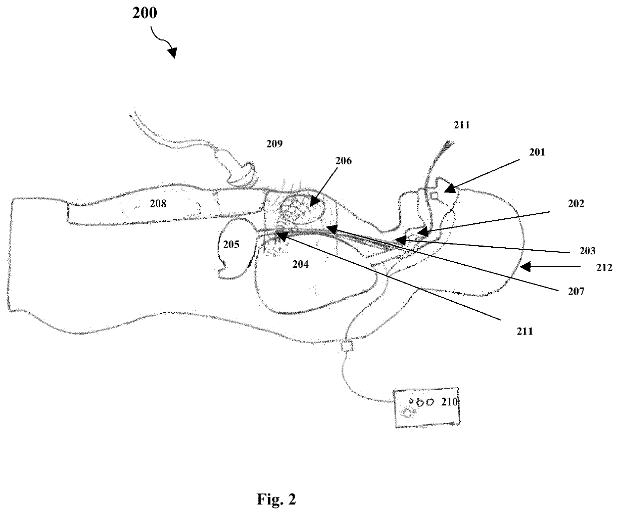 System for simulation training of extra corporeal life support therapies