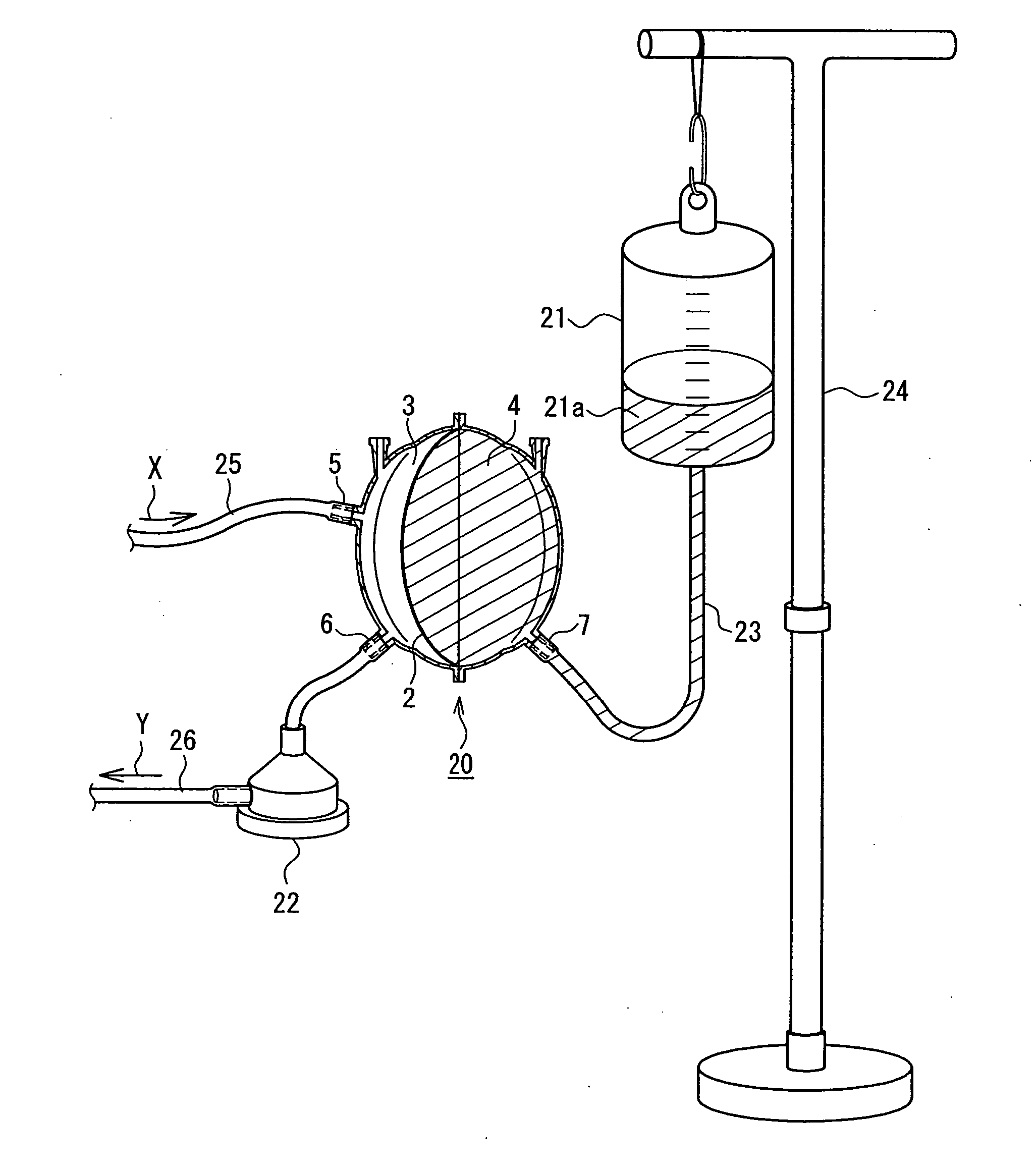 Extracorporeal blood circulating apparatus, closed-type venous reservoir and extracorporeal blood circulating method