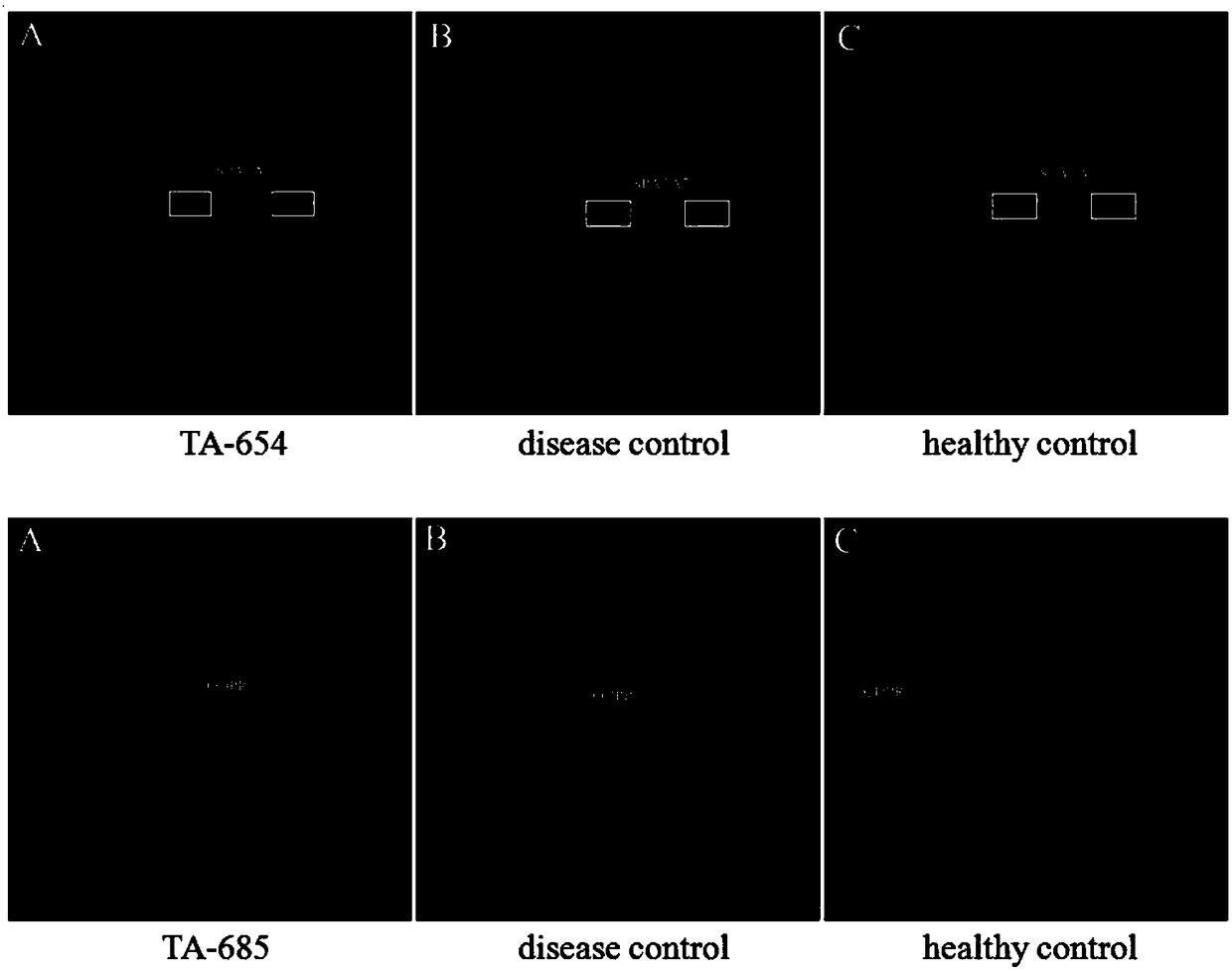 Biomarker panel for TA (Takayasu arteritis) detection and application of biomarker panel