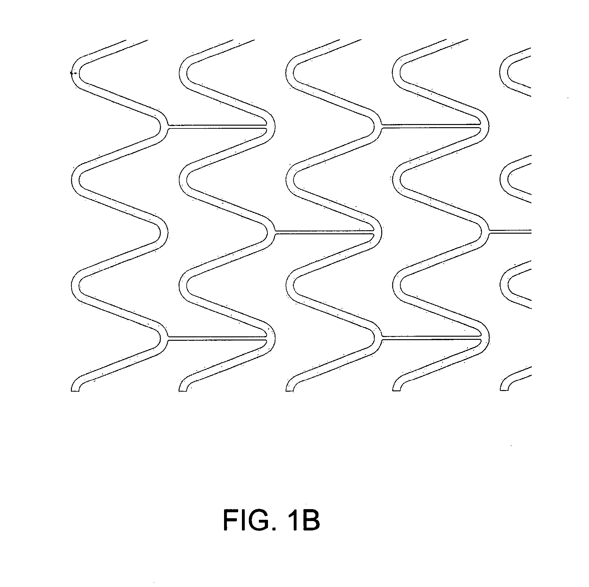 Expandable vascular endoluminal prostheses