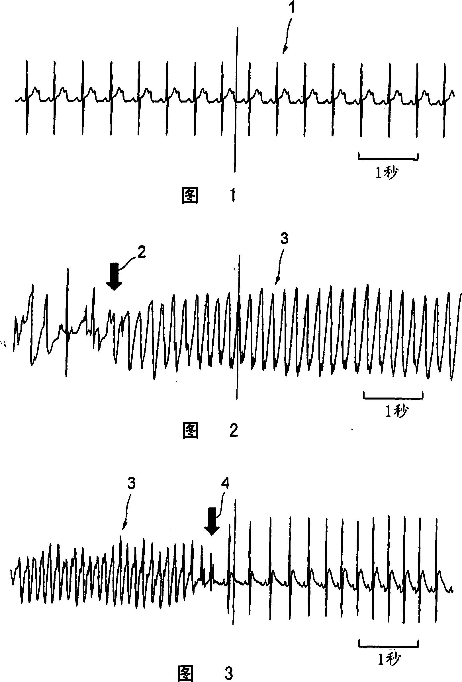 Muscle relaxation accelerator and therapeutic agent for muscular tissue diseases such as muscle relaxation failure