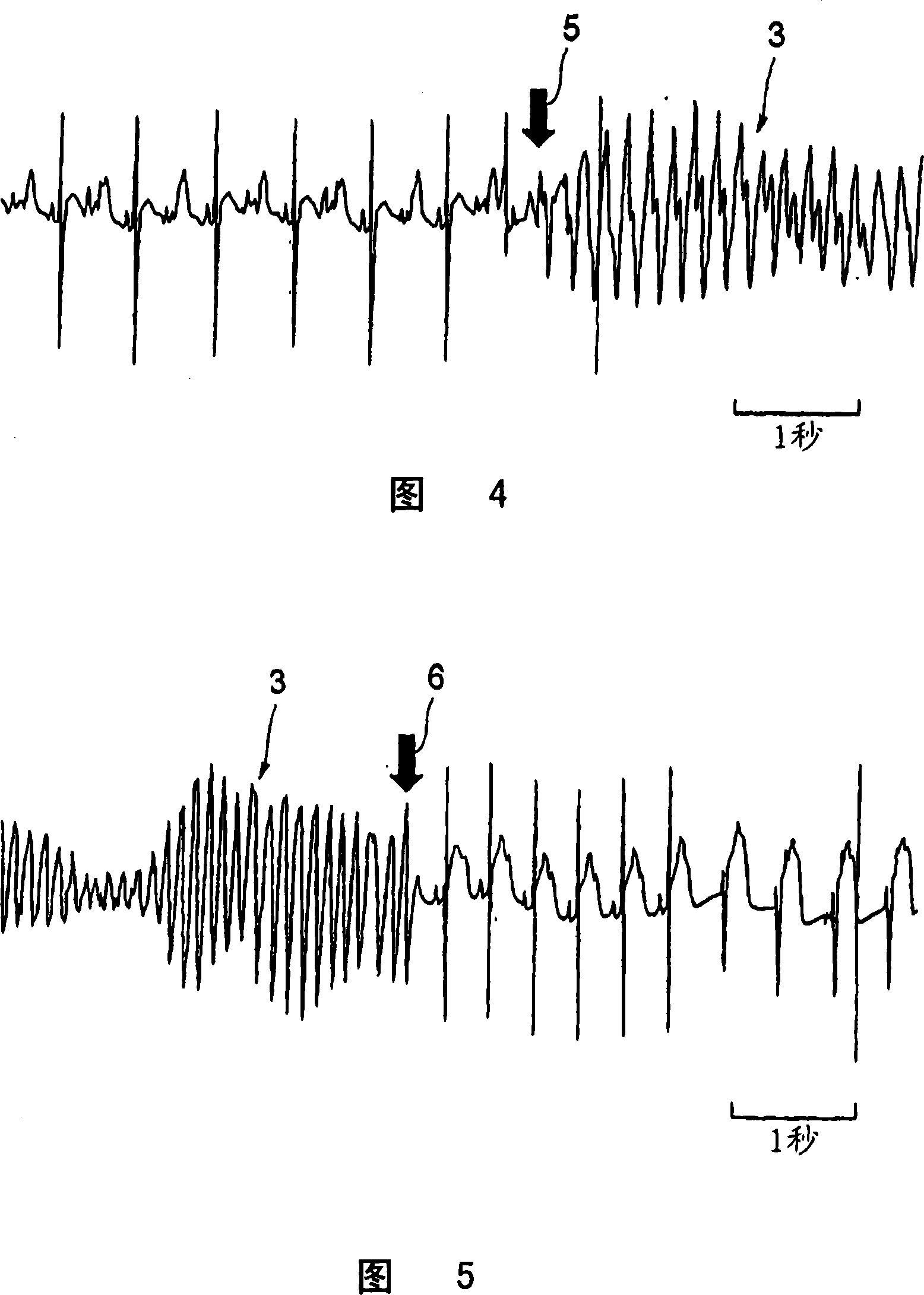 Muscle relaxation accelerator and therapeutic agent for muscular tissue diseases such as muscle relaxation failure