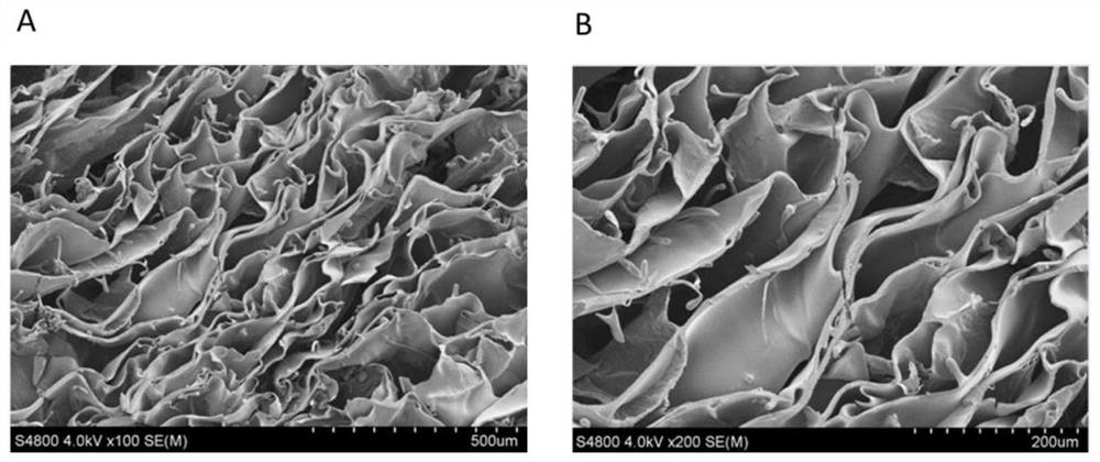 Budesonide-loaded chitosan sponge