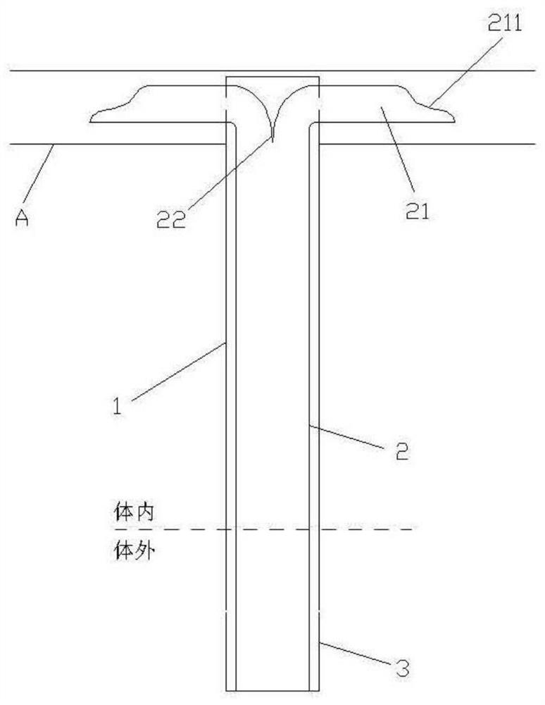 Postoperative drainage tube