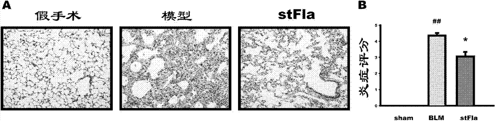 Use of Toll-like receptor 5 (TLR5) agonist stFla in anti-pulmonary fibrosis