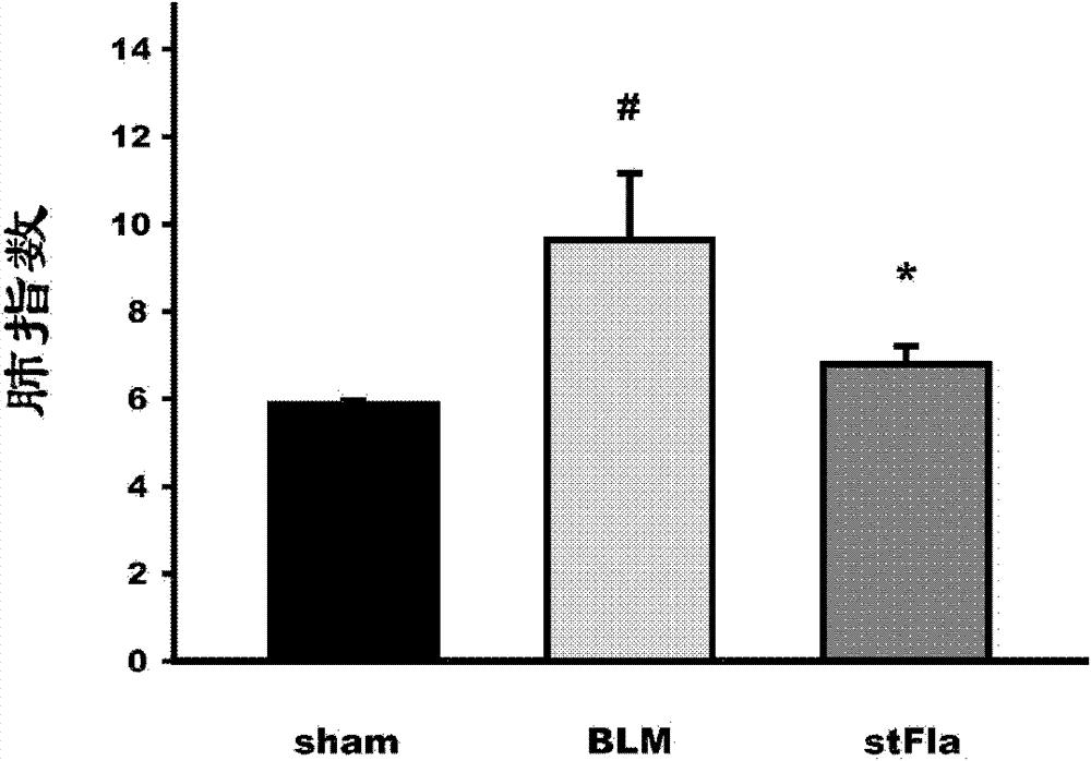 Use of Toll-like receptor 5 (TLR5) agonist stFla in anti-pulmonary fibrosis
