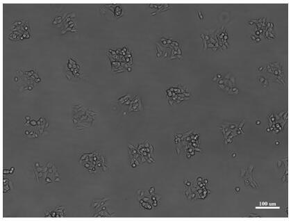 Application of tannic acid serving as micro-contact printing ink to cell patterning