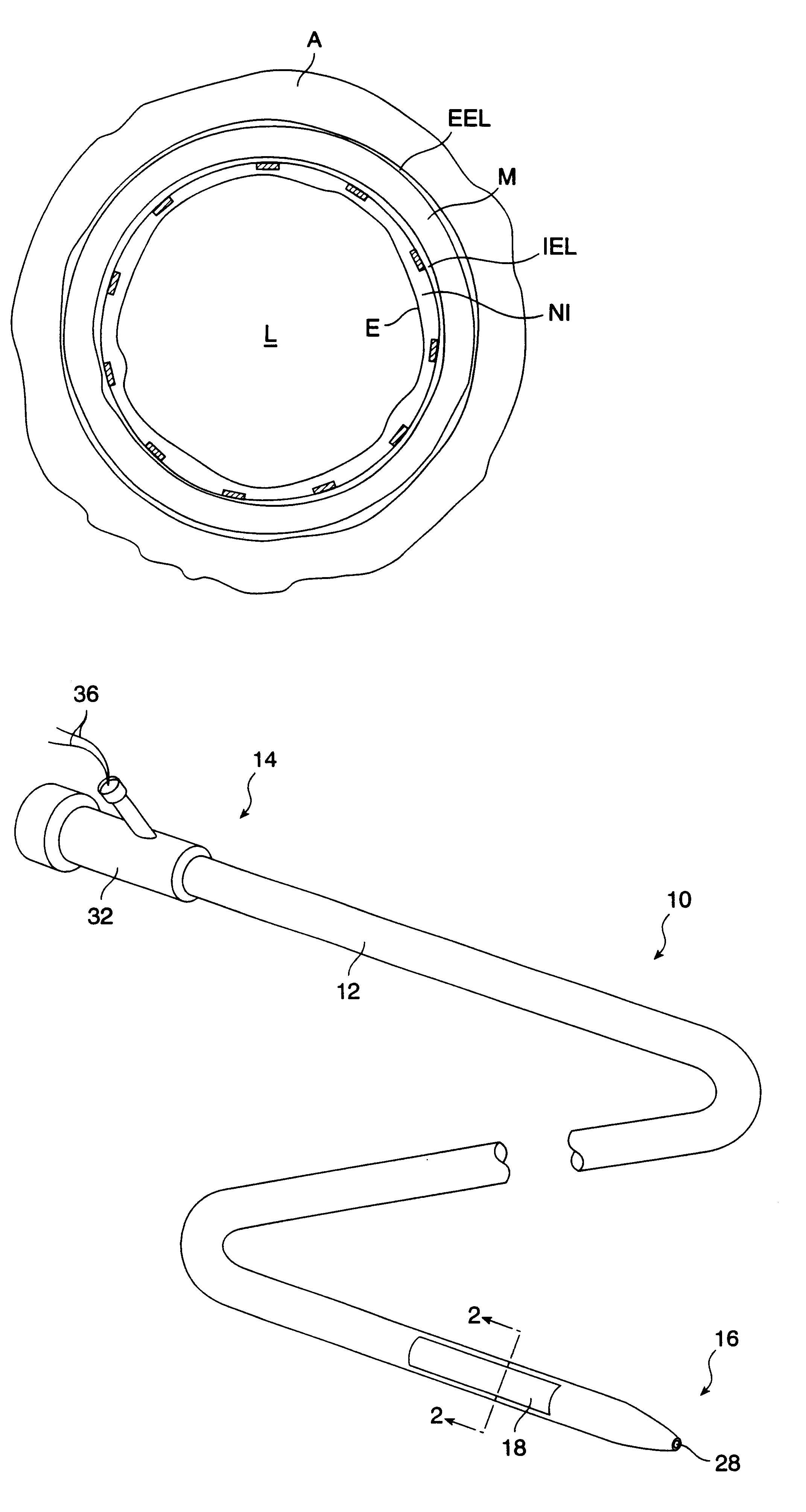 Methods and systems for the inhibition of vascular hyperplasia