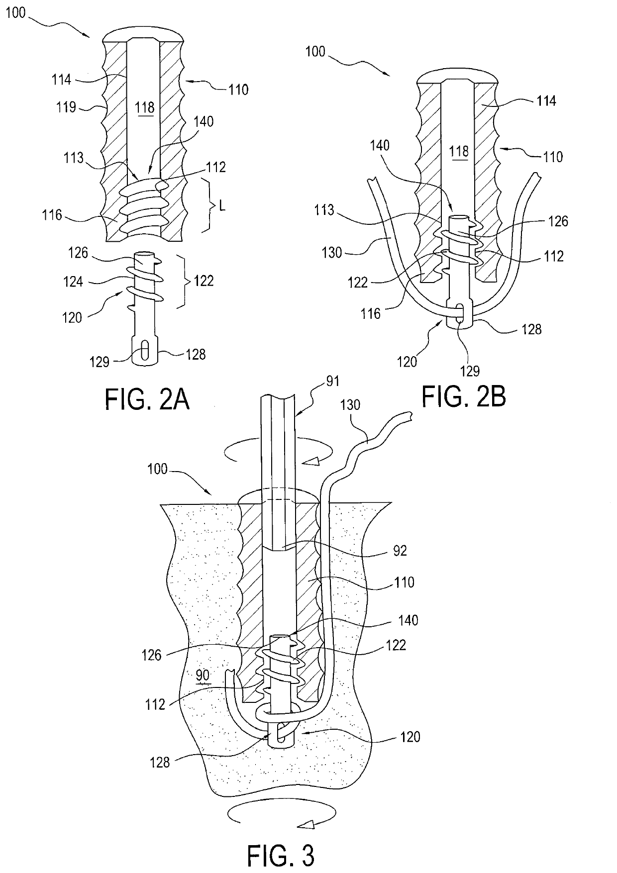 Slack reducing suture anchor assembly and method of tissue repair