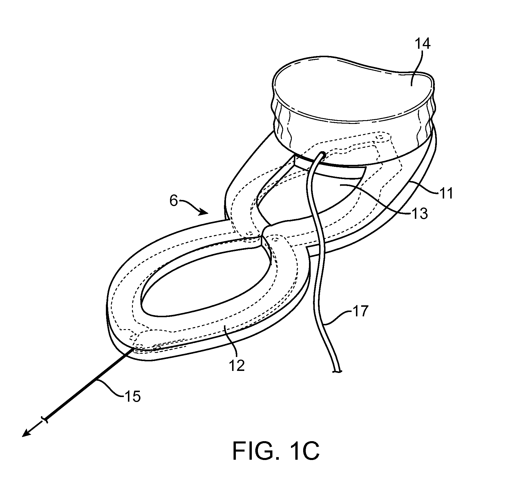 Intra-vaginal devices and methods for treating fecal incontinence