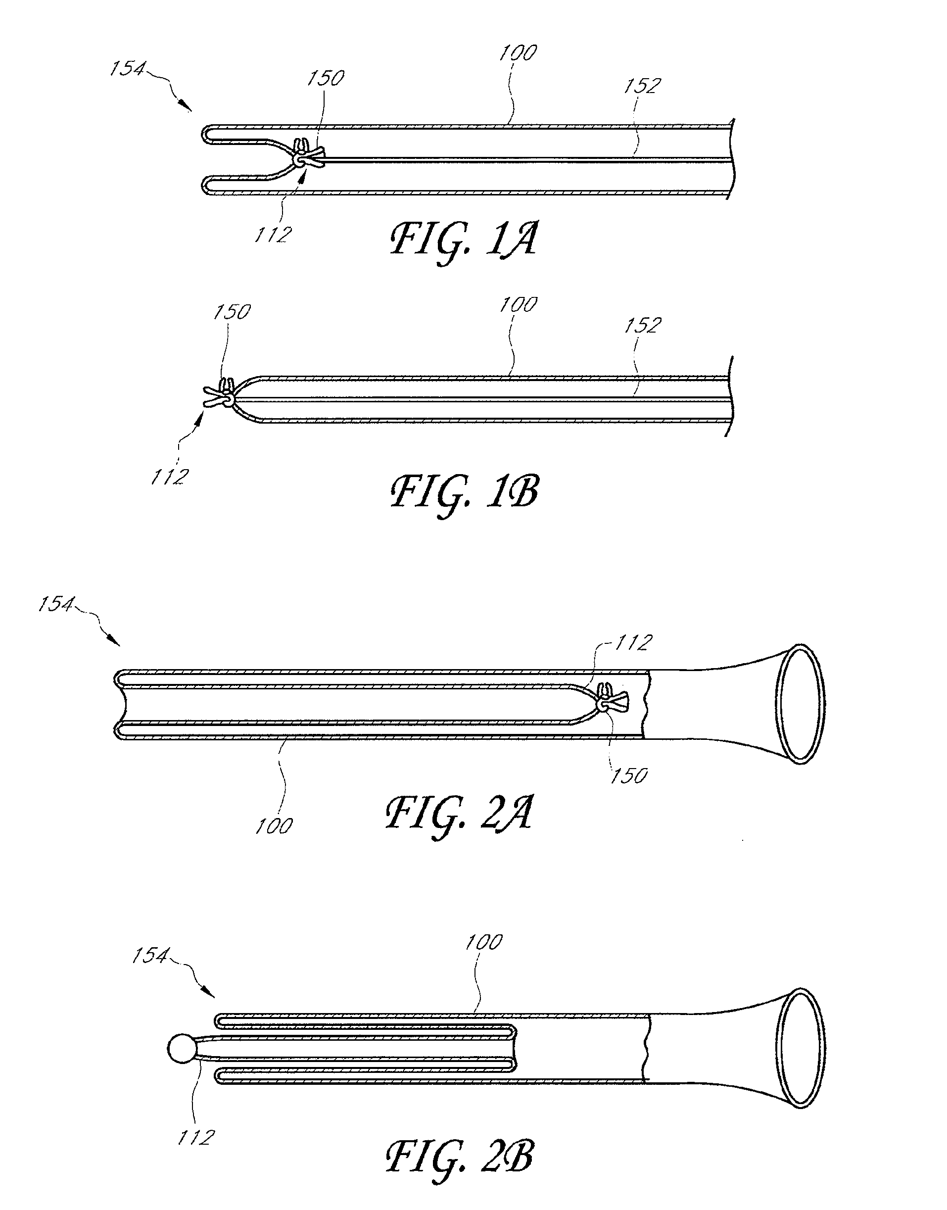 Toposcopic methods and devices for delivering a sleeve having axially compressed and elongate configurations
