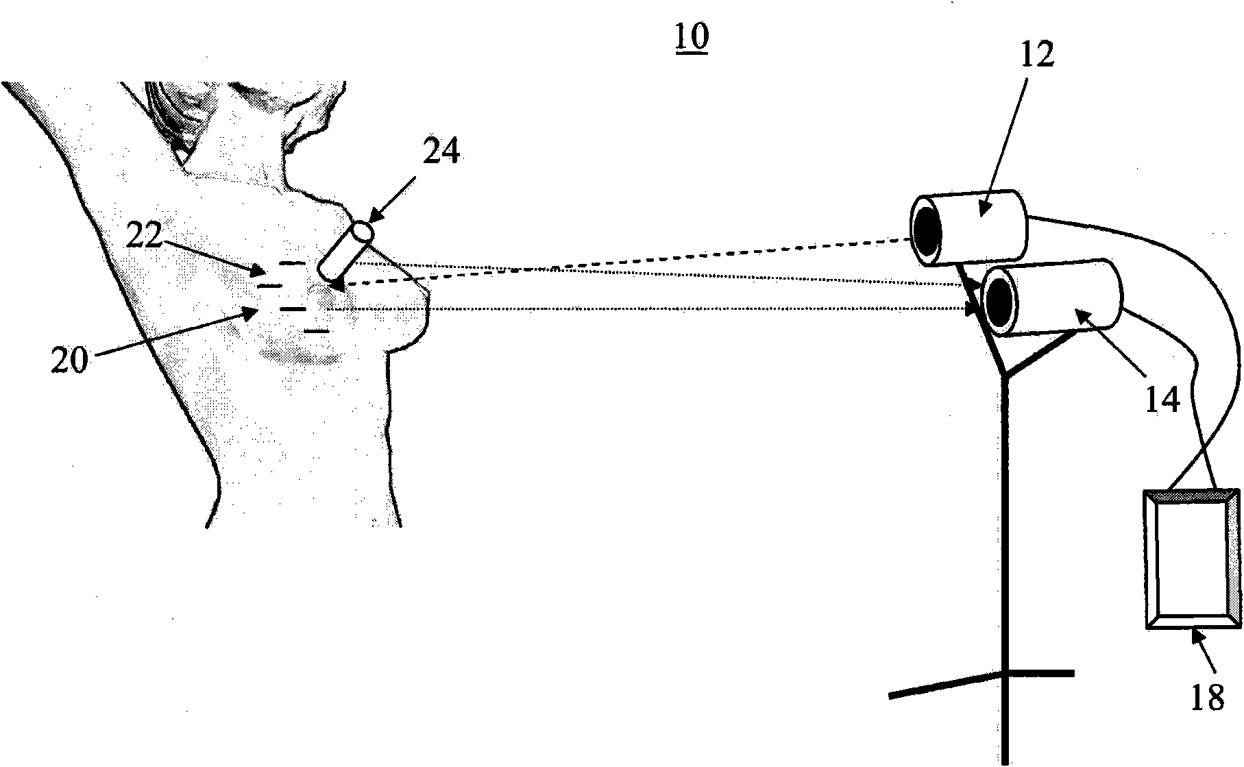 System and method for registration of imaging data