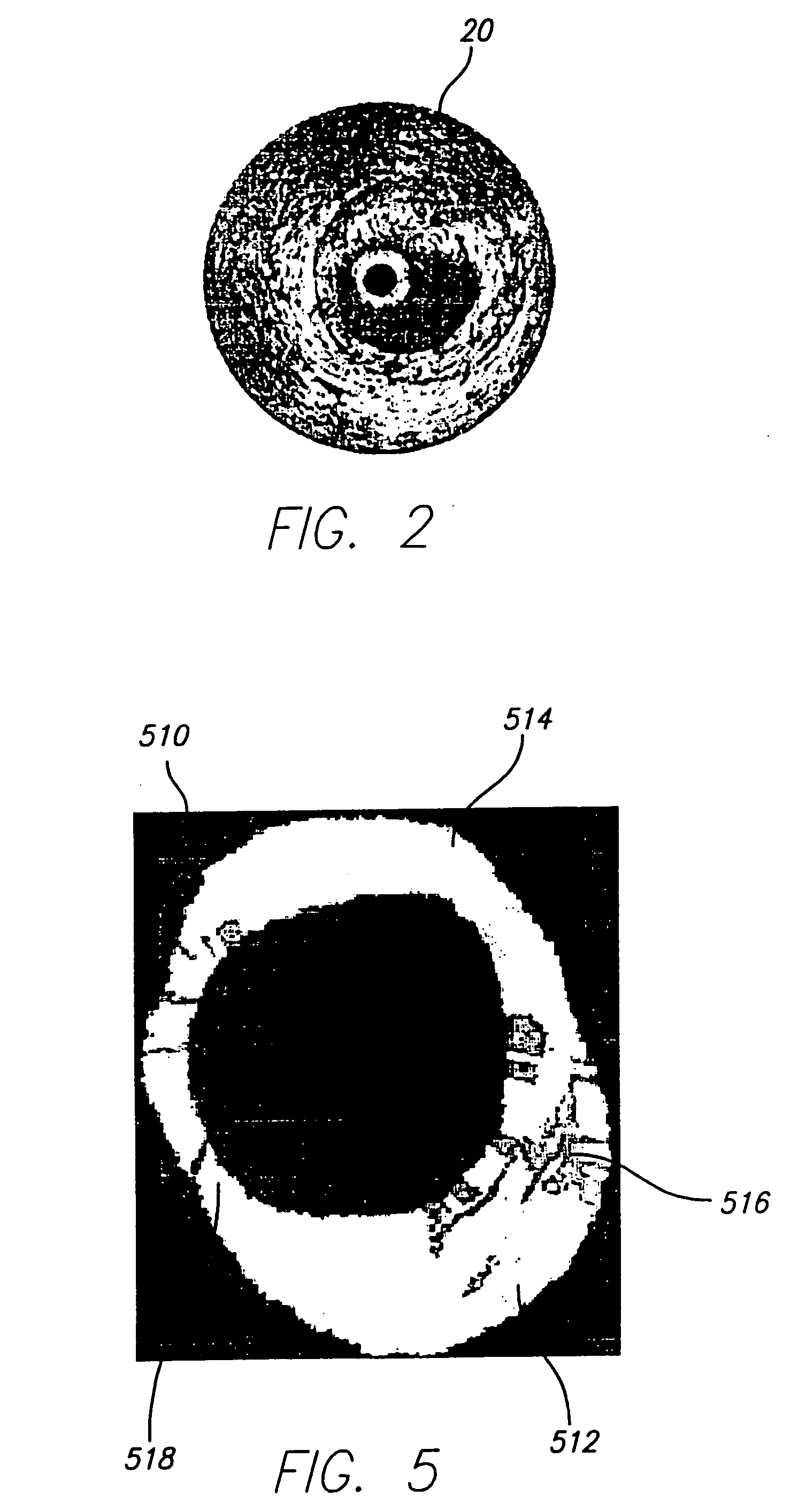 System and method of characterizing vascular tissue