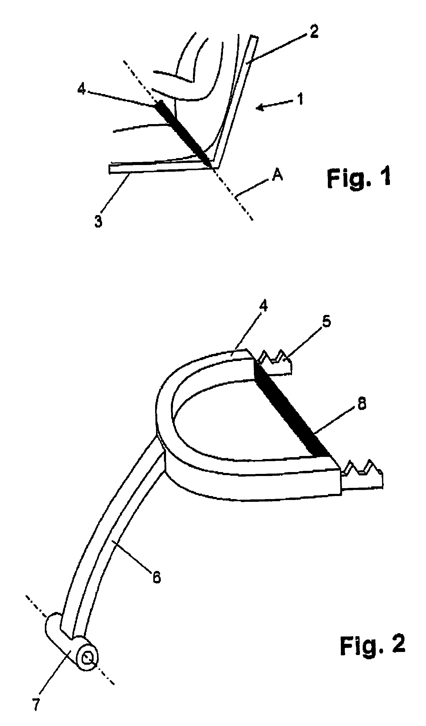 Retaining system