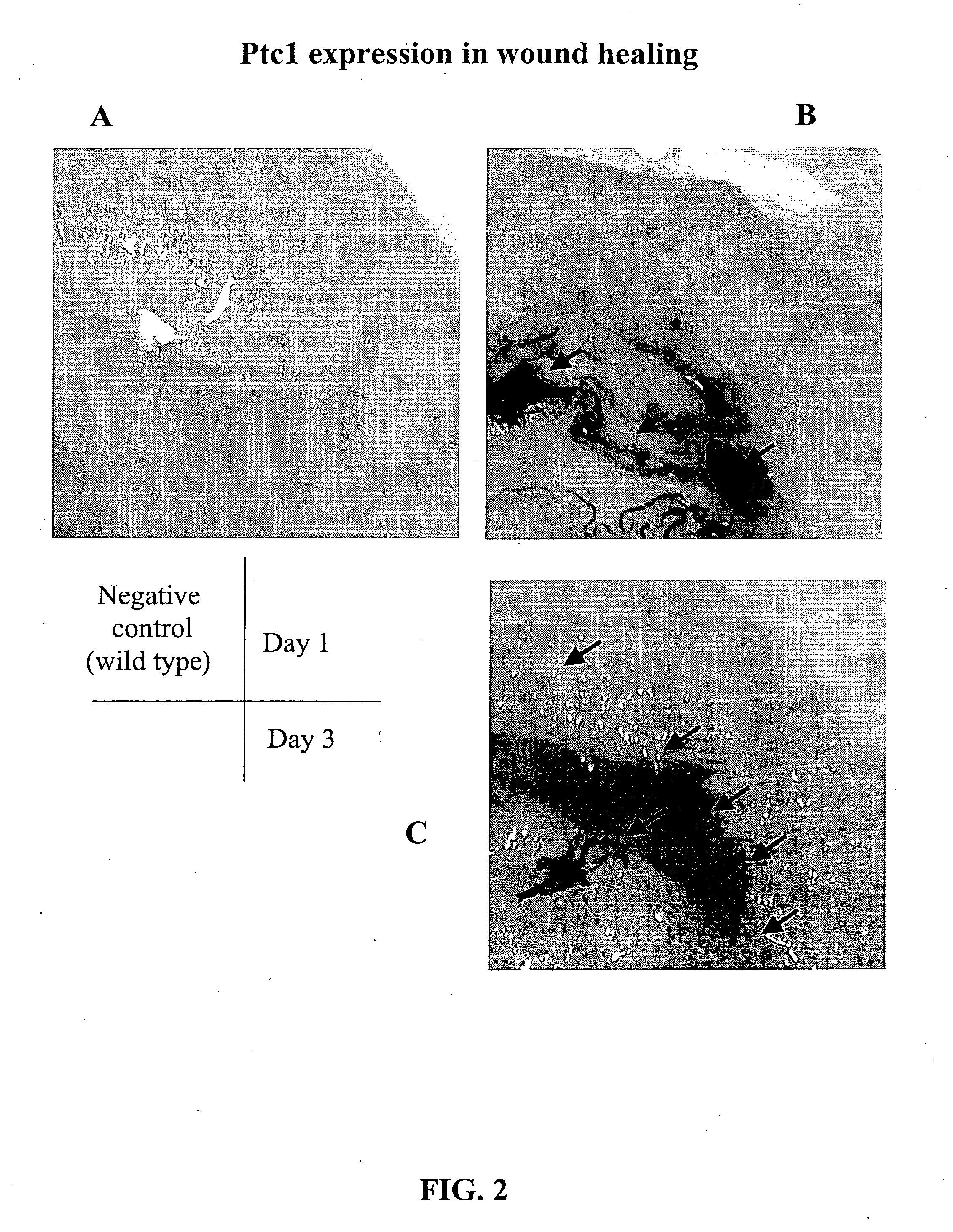 Morphogen compositions and use thereof to treat wounds