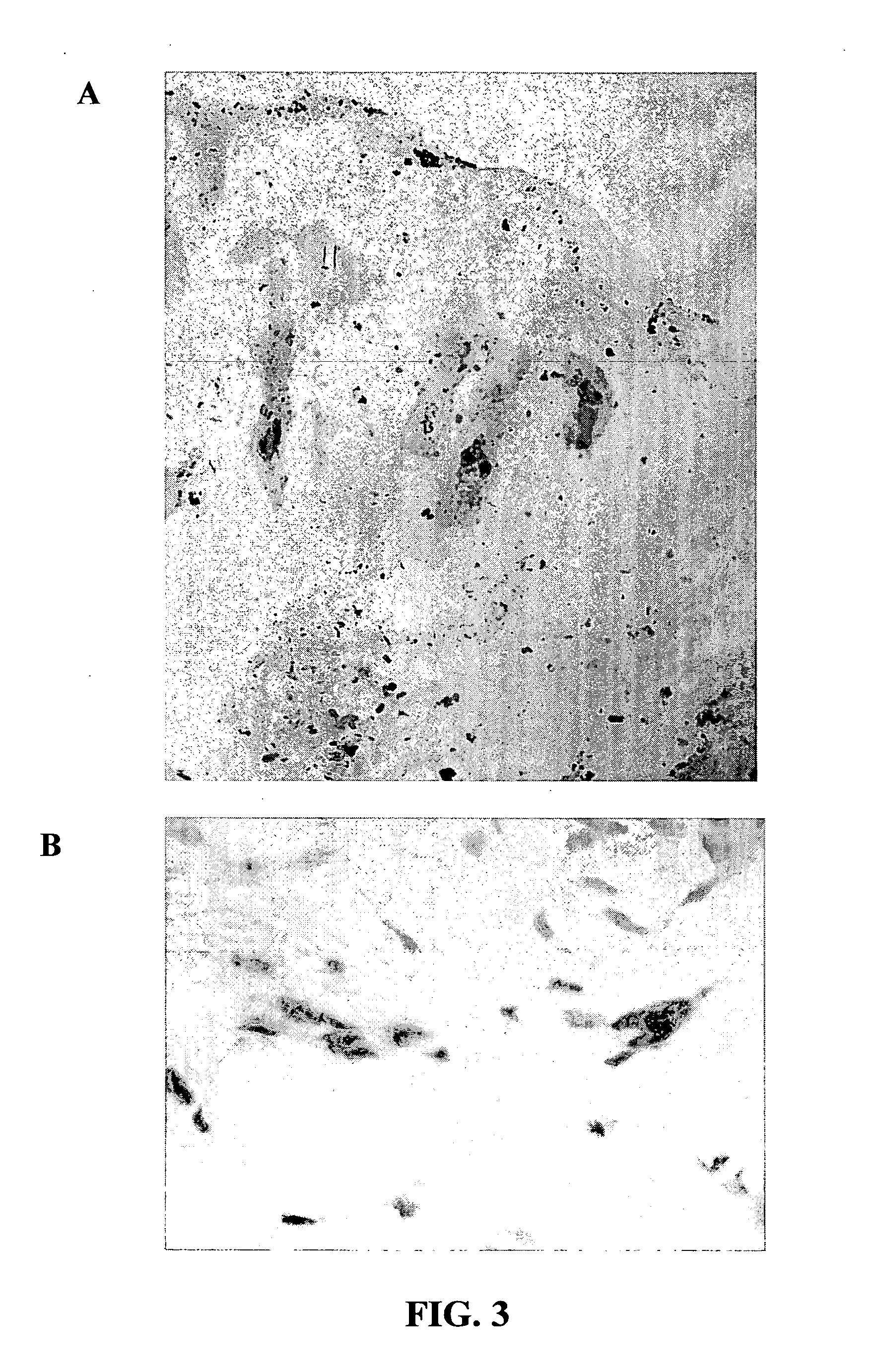Morphogen compositions and use thereof to treat wounds