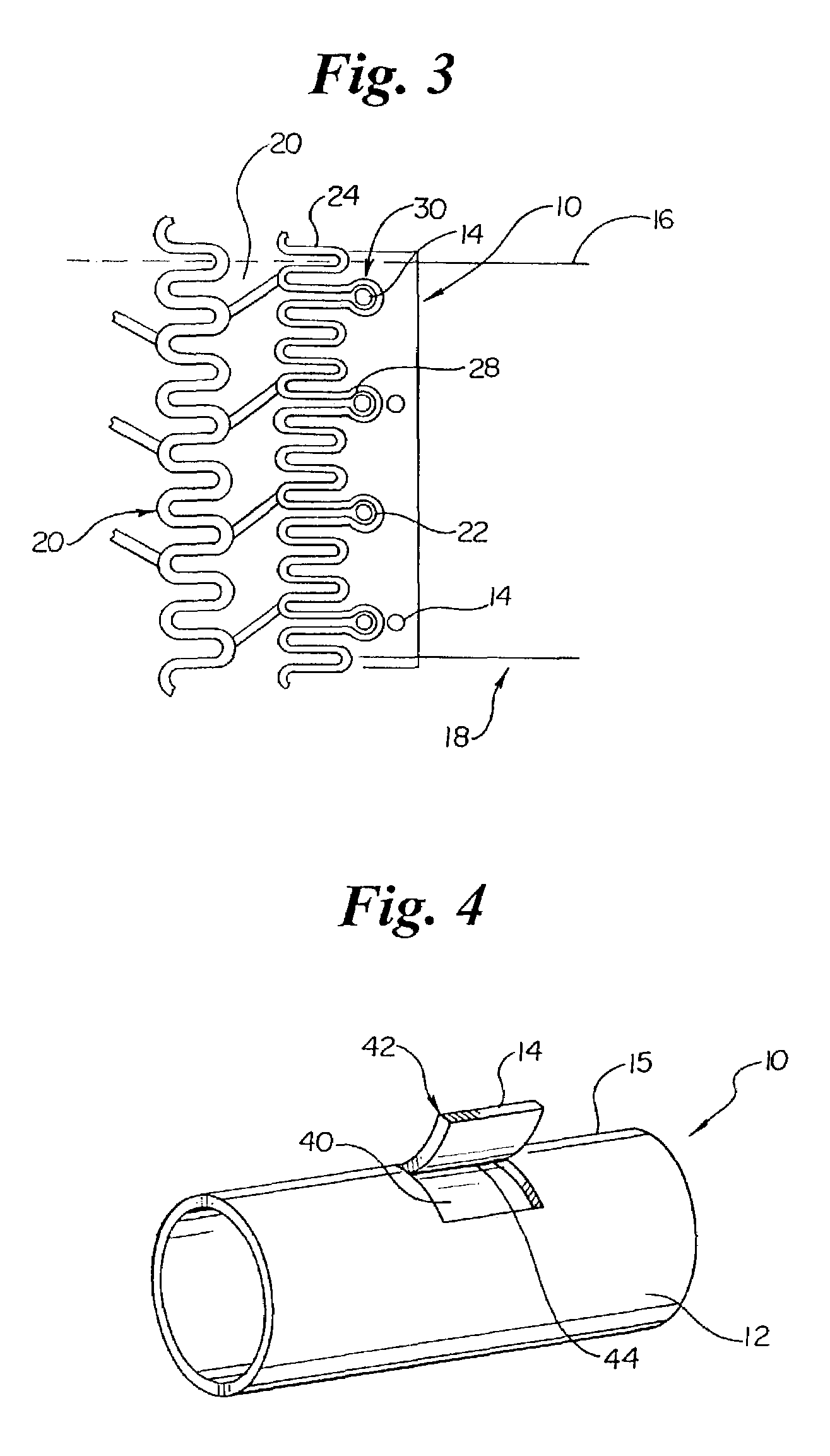 Stent delivery system with securement and deployment accuracy