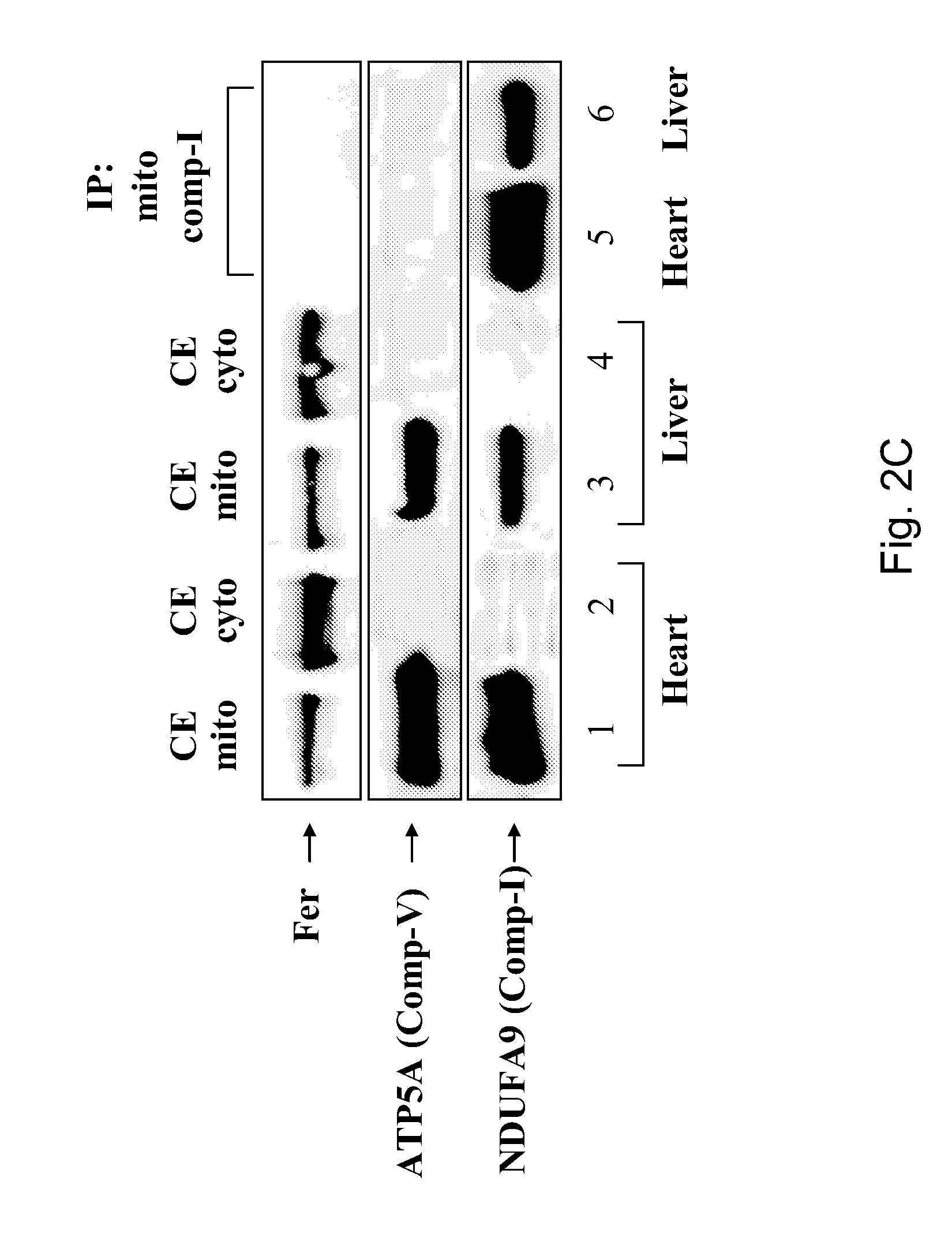 Drug Combination Comprising A Glycolysis Inhibitor And A Tyrosine Kinase Inhibitor