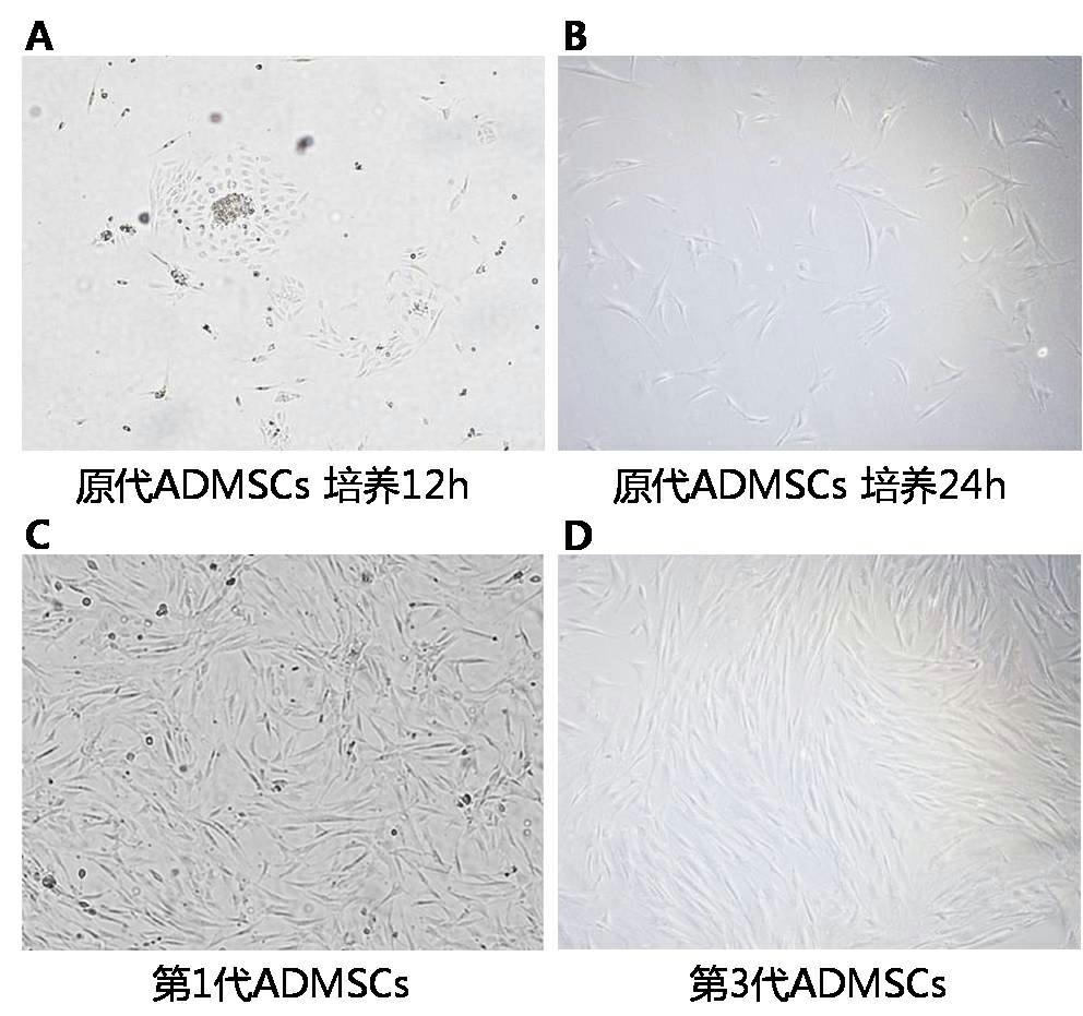 Stem cell combined growth factor injection for promoting angiogenesis in ischemic tissue and its preparation method and use method