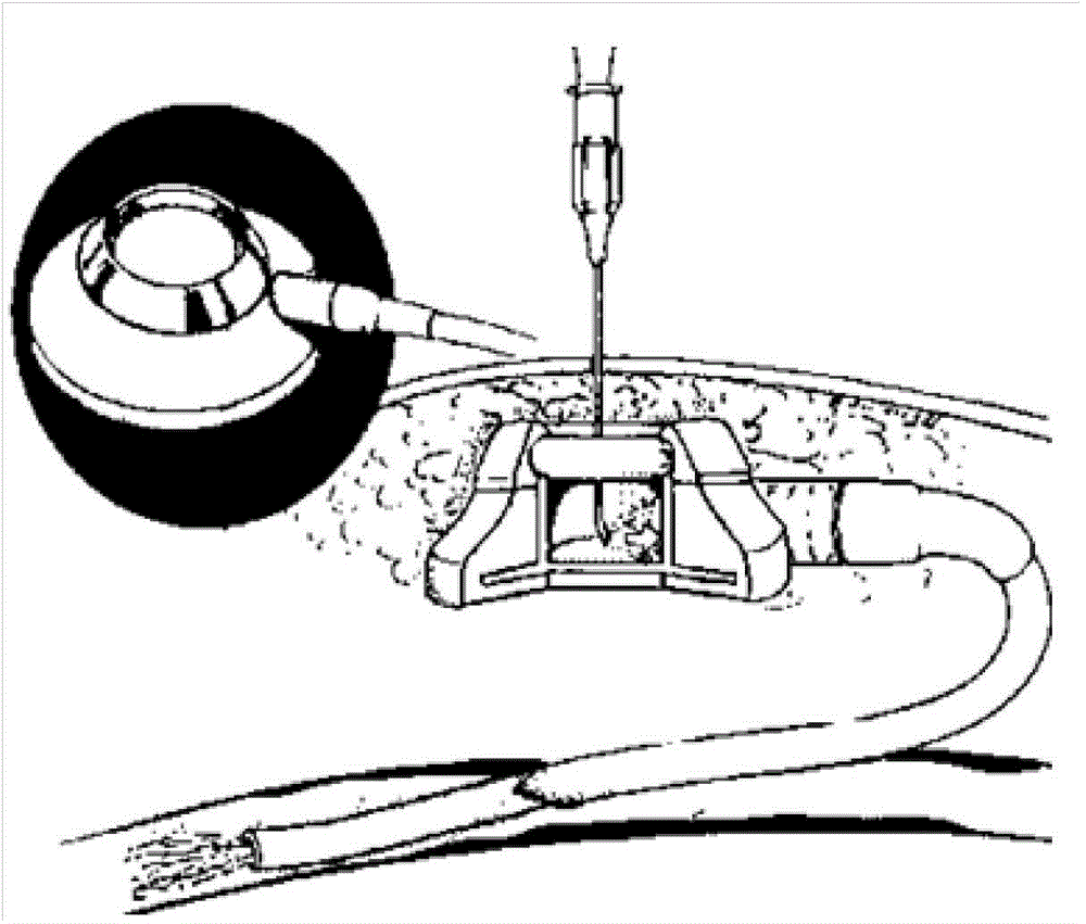 Method for establishing large animal liver damage model