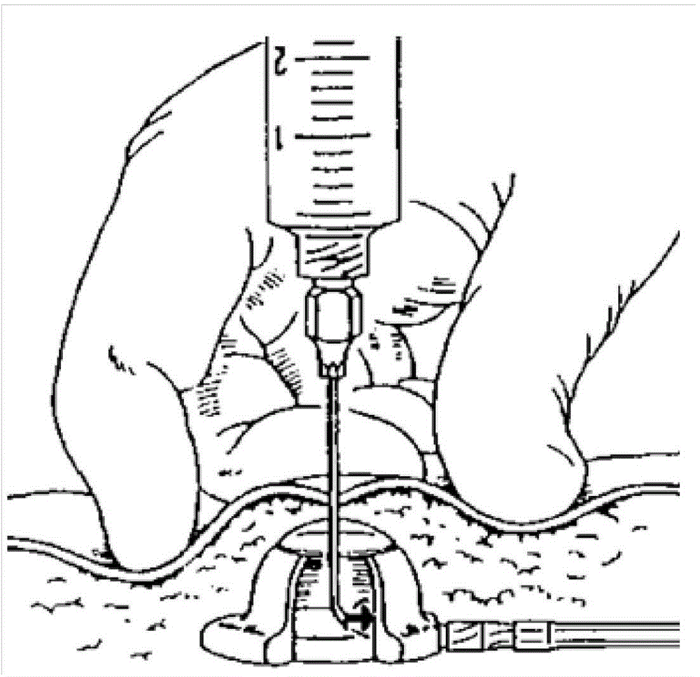 Method for establishing large animal liver damage model